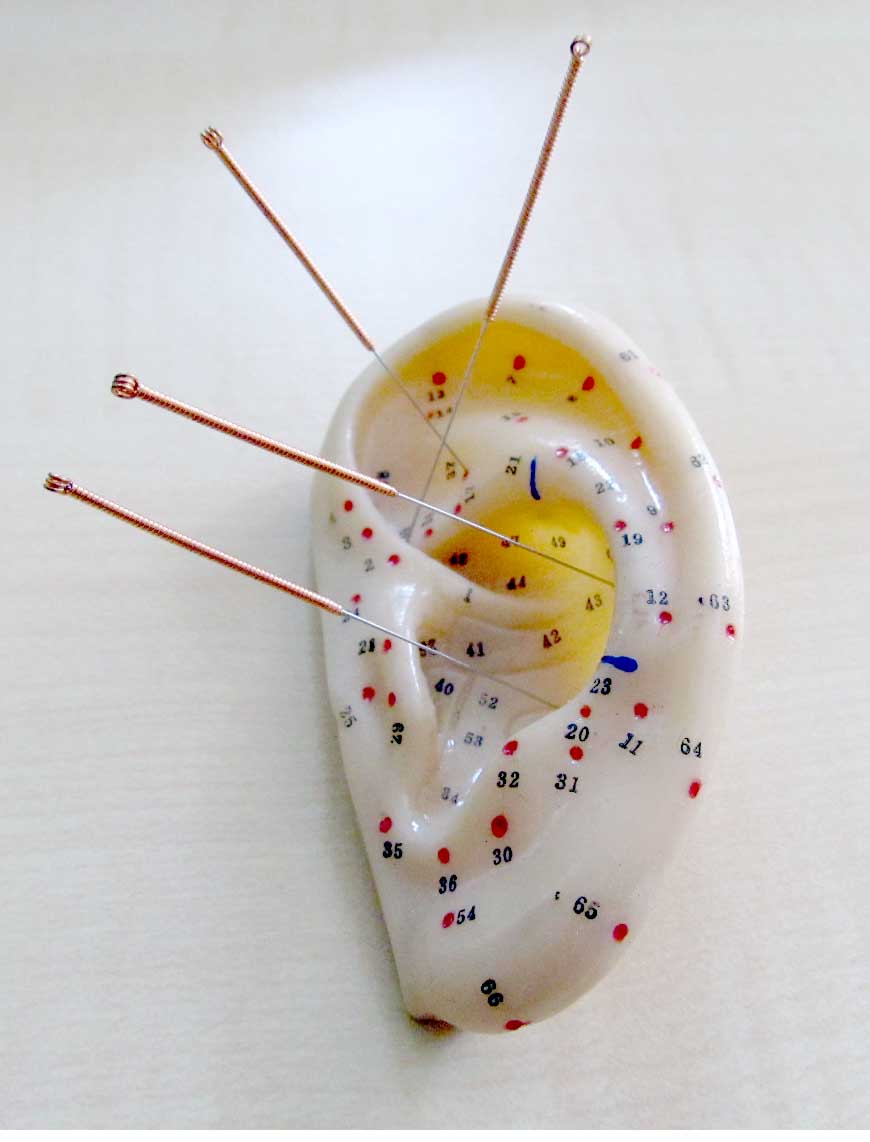 Otto Akupunktur Schmerztherapie